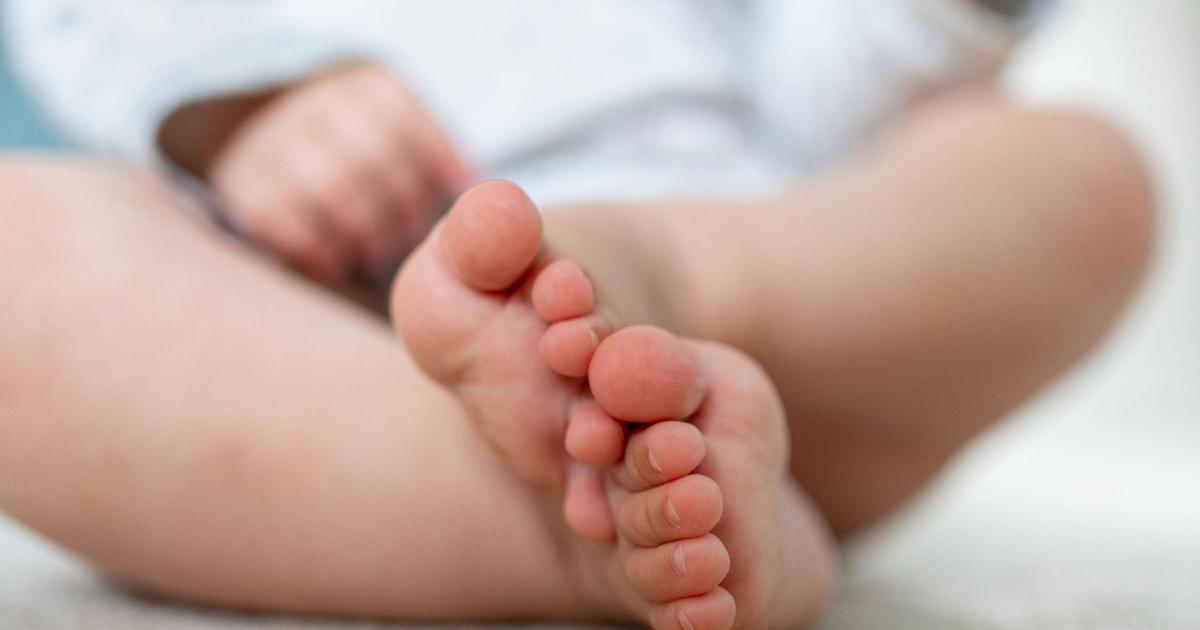 Rollout of genetic test to help prevent deafness in babies in Scotland