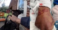 'Hostile takedown' | Cincinnati teen hospitalized after police dog attack during warrant execution speaks out