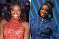 Simone Biles reveals plastic surgery procedures she’s had done