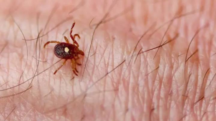 La espeluznante muerte de un hombre después de comer una hamburguesa, estos fueron sus síntomas