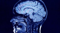 Human brains have 5 distinct ‘epochs’ in a lifetime, study finds