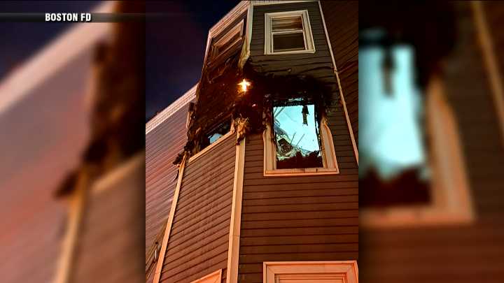 Dorchester fire sends one person to the hospital