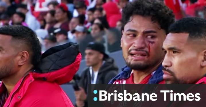 All three of Katoa's head knocks