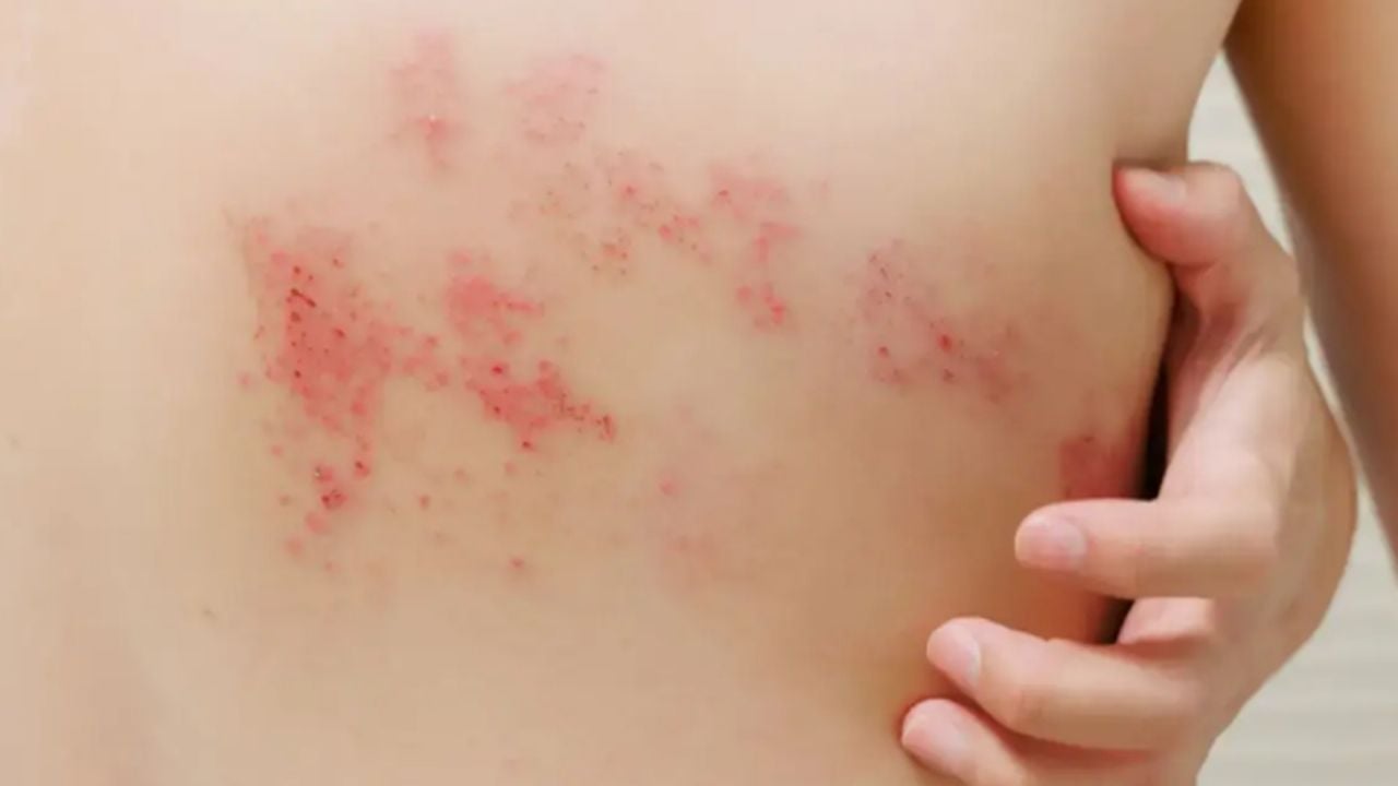 La vacuna esencial para adultos mayores de 50