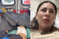 VIDEO: Gaby Ramírez, colaboradora del programa “Hoy”, fue atacada brutalmente por un perro
