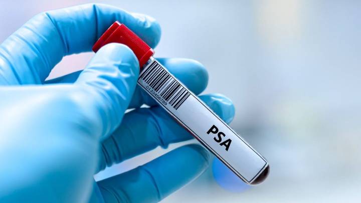 Why only some men will get prostate cancer screening