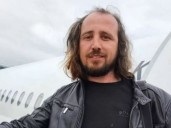 Viajó a otro país para hacerse implantes capilares y dentales y murió en la operación