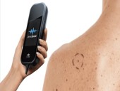 Nuevo dispositivo médico portátil promete detectar enfermedades antes de síntomas