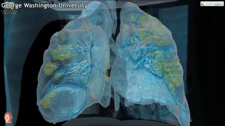 Expert to speak at local Pulmonary Arterial Hypertension group meeting