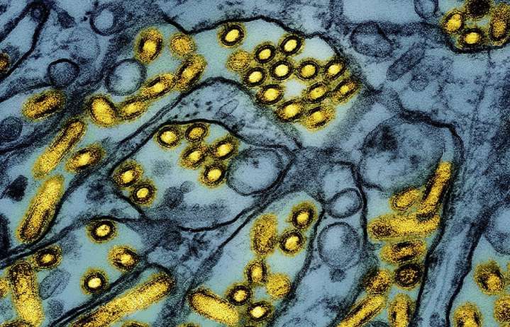 WA confirms first bird flu case in a resident this year