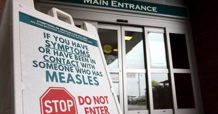 Canada loses measles elimination status year after outbreak