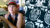 El caso médico de la mujer de Tennessee diagnosticada con demencia a los 46 años: 'Es difícil creer algo así a una edad tan joven'