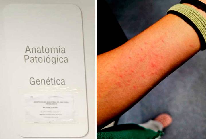 Intoxicaciones en el hospital de Toledo: denuncian no tener explicación tras un año y la Junta defiende mediciones negativas