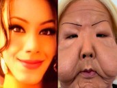 Influencer inicia reconstrucción facial tras quedar desfigurada en procedimiento clandestino