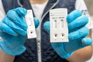 Este lunes, capital aplicará pruebas gratuitas de VIH