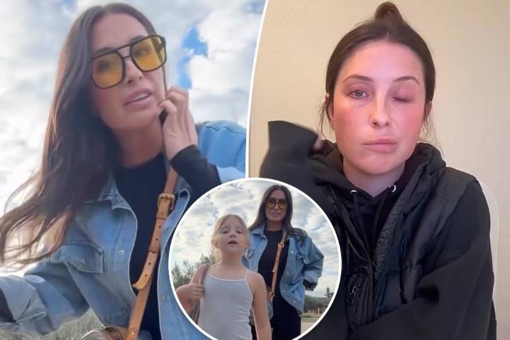 Bristol Palin gives disappointing update on facial paralysis