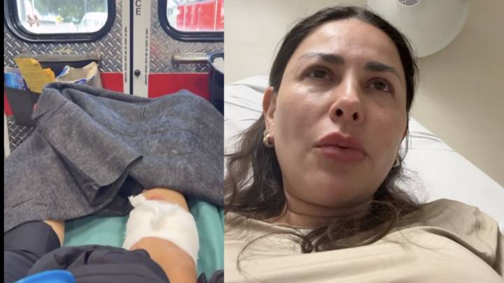 Perro mordió a Gaby Ramírez y pasó horas con la herida abierta: "Mi pierna está destrozada"