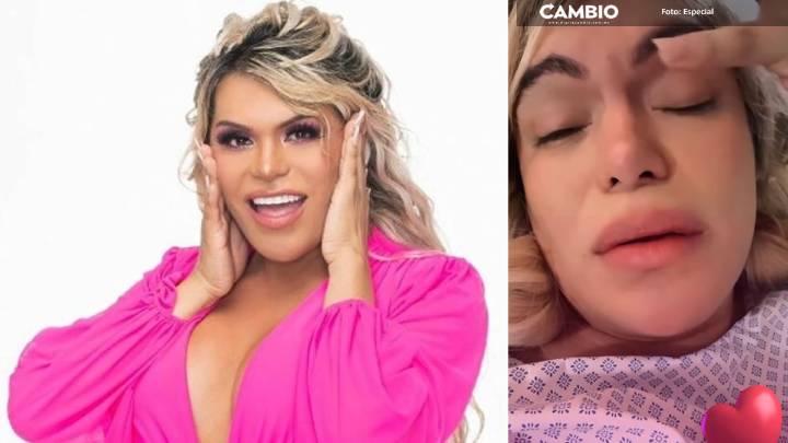 Wendy Guevara preocupa a sus fans por reaparecer llorando tras cirugía estética ¿Está bien? (VIDEO)