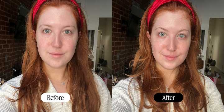 Medicube Age-R Booster Pro Review: I Tried the Viral Device 2025