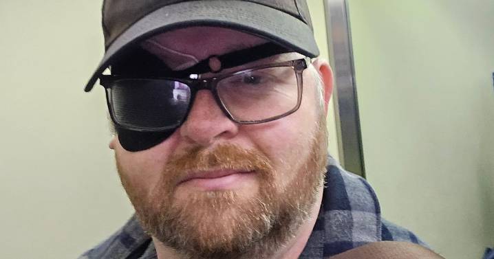 Bloke felt like 'teen again' after rare condition left him with 'boob hallucinations'