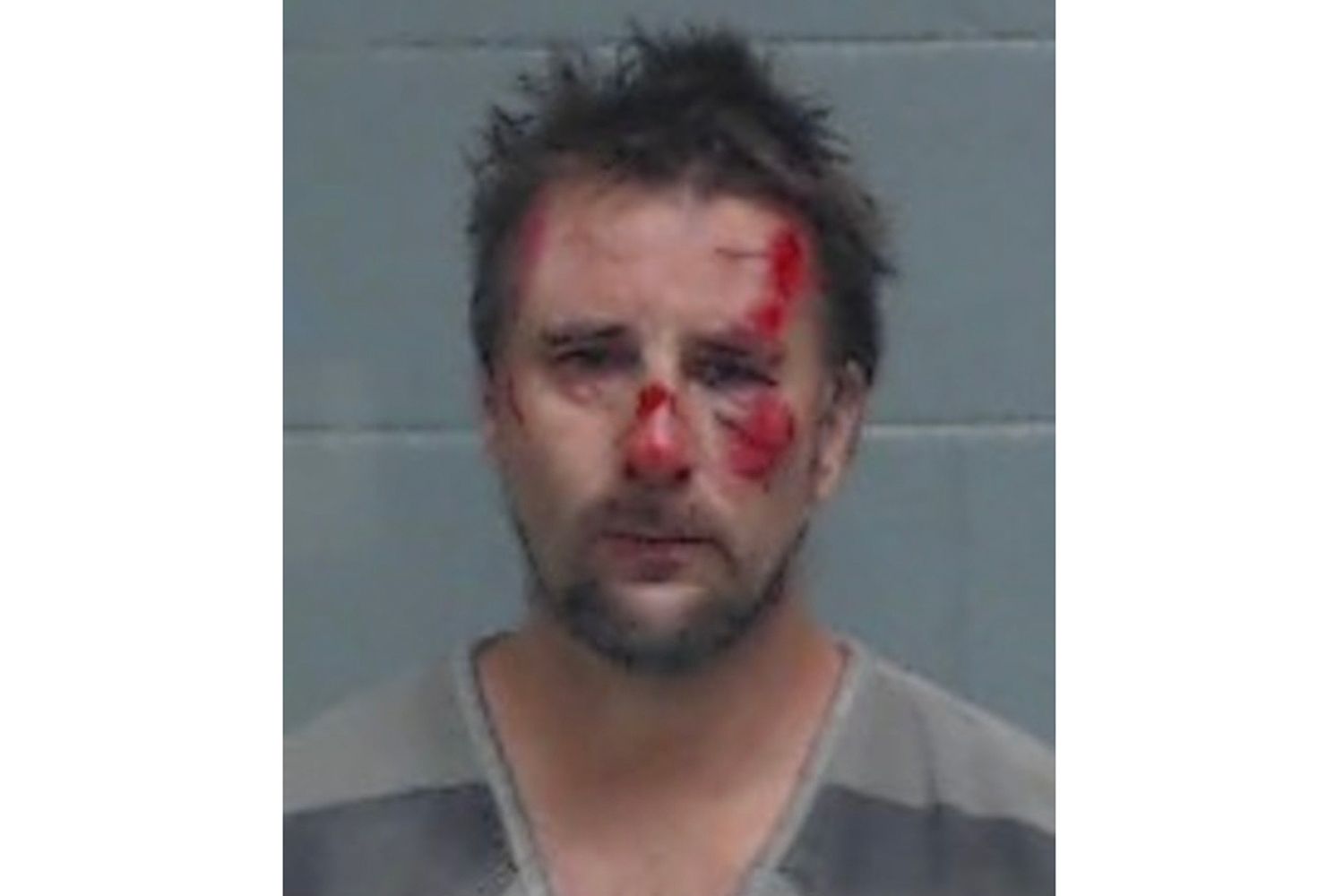 Bloody Mugshot of Dad After Jumping From Moving Car During Police Pursuit
