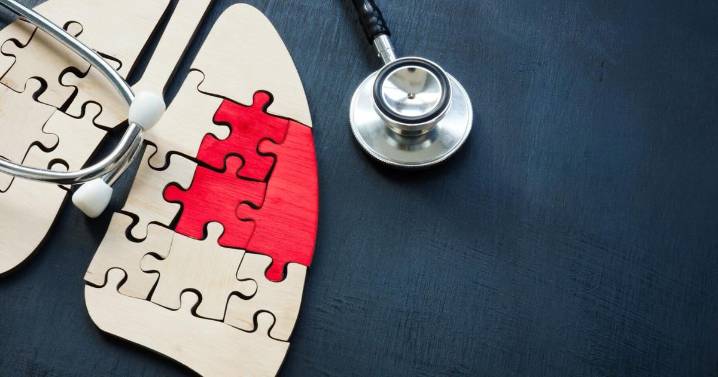 (Opinión) Noviembre: Un llamado a respirar conciencia sobre el cáncer de pulmón