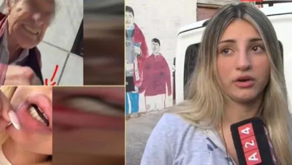 Brutal ataque: vecino golpeó a una joven por mal estacionamiento