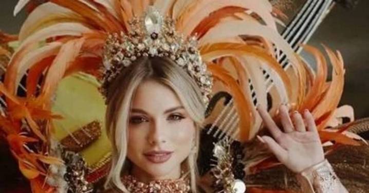 Miss Argentina confesó una condición física que ocultó