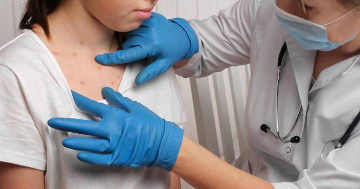 Alerta sanitaria por la circulación de cuatro viajeros con sarampión por distintas provincias del país