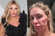 Brandi Glanville shares new health update after grueling battle with her facial disfigurement