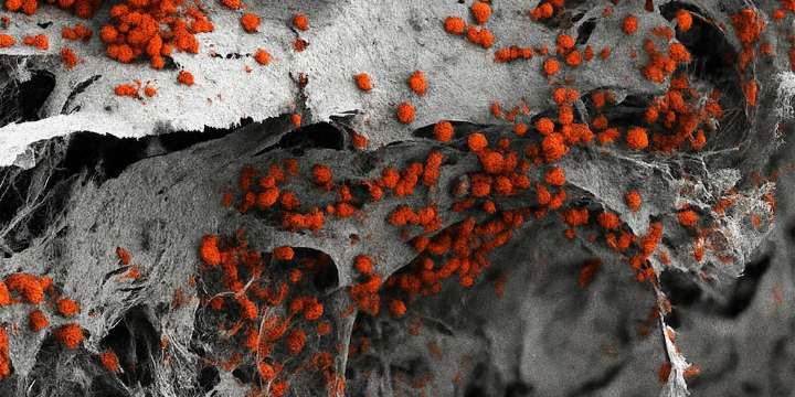 Crean la primera médula ósea humana en laboratorio para estudiar y tratar distintos tipos de cáncer