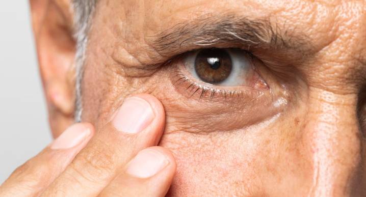 Mitos y desinformación frenan la donación de córnea en el Perú