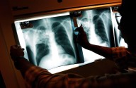 Lung cancer is #1 cause of cancer death in Washington. Why?