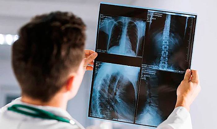 8 de noviembre: Día Mundial de la Radiología