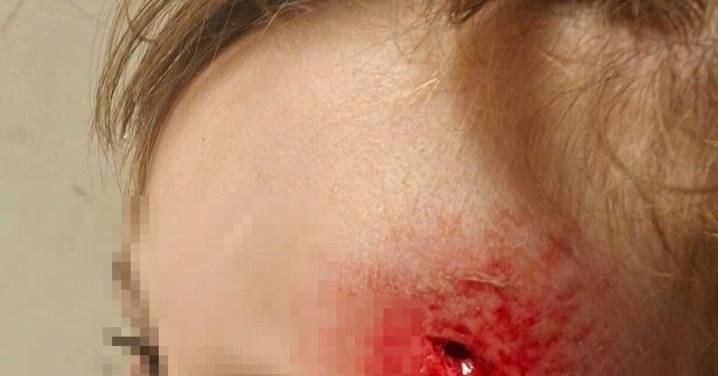 Herido un niño de 5 años tras atropellarlo un conductor en patinete que se dio a la fuga en Manilva: "Iba a una velocidad impresionante"