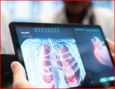 Instituto Nacional de Cancerología fortalece las estrategias de diagnóstico temprano del cáncer de pulmón