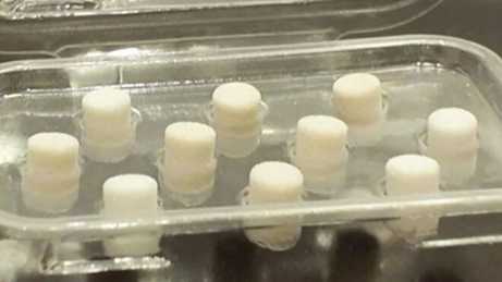 Coral from the sea is being used in some knee surgeries in NYC. Here's how, and why