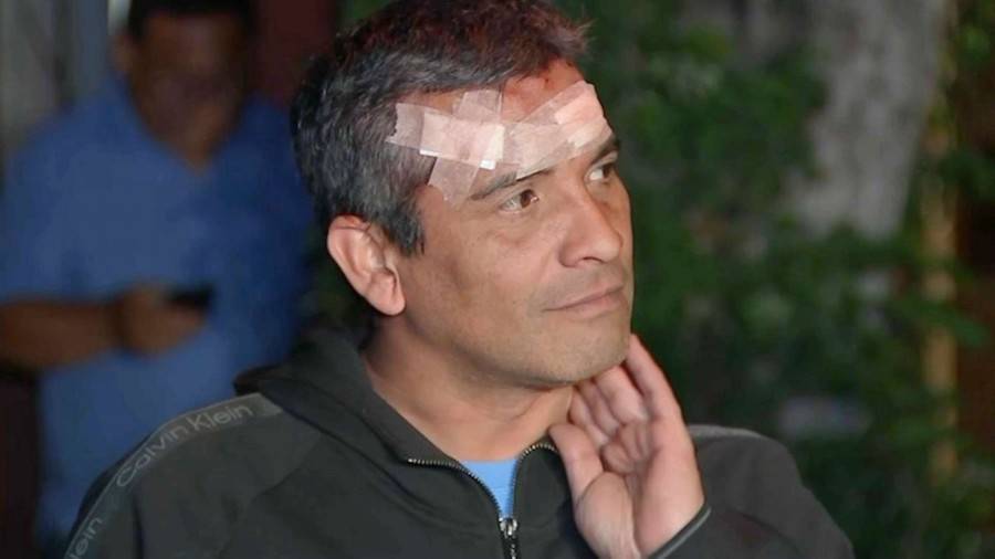 “Uno de ellos me empezó a asfixiar”: Conductor sufrió brutal golpiza durante encerrona en Conchalí