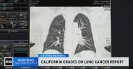 California ranks among best in nation in State of Lung Cancer report
