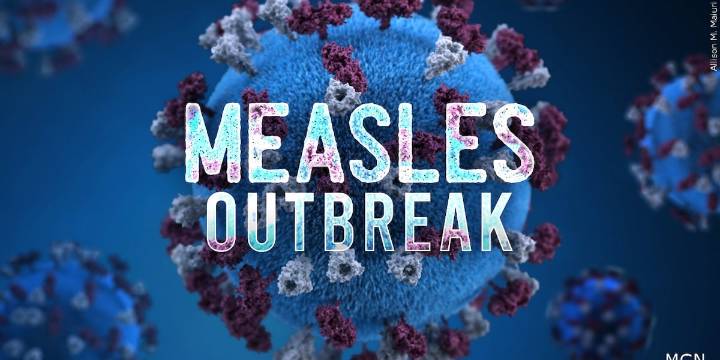 DPH identifies measles exposure at Spartanburg restaurant amid outbreak