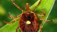 NJ man first known to die of meat allergy triggered by tick bite
