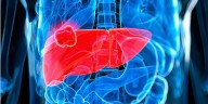Estos son los 5 principales síntomas del cáncer de hígado