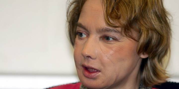 A 20 años del primer trasplante de cara: entre la innovación y los desafíos pendientes de la ciencia