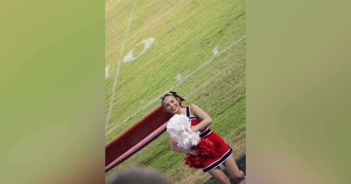 Crowley Community rallies to support teen burn victim