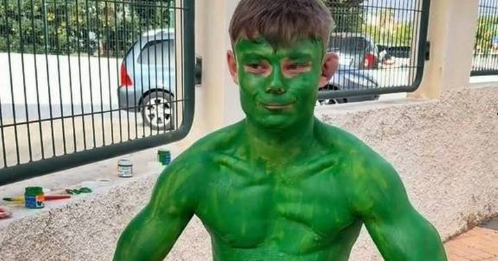 Benidorm tourist needs six baths after 'paint mistake' for Hulk outfit