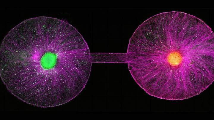 Ethics concerns spur call for oversight of neural organoid research