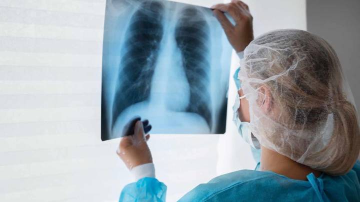 TB burden dips but India far from elimination target, says global TB report