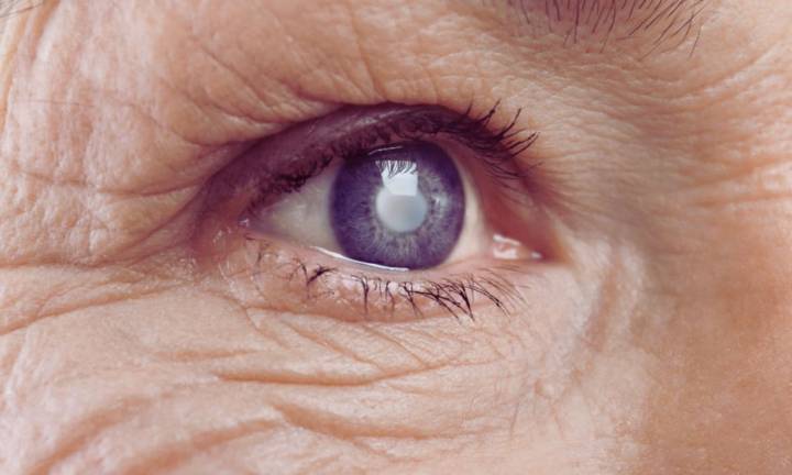 Age-Related Eye Diseases Raise Risk of Heart Disease–Depression Combo, Long