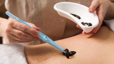 En México no se usan las sanguijuelas por prejuicios: médico