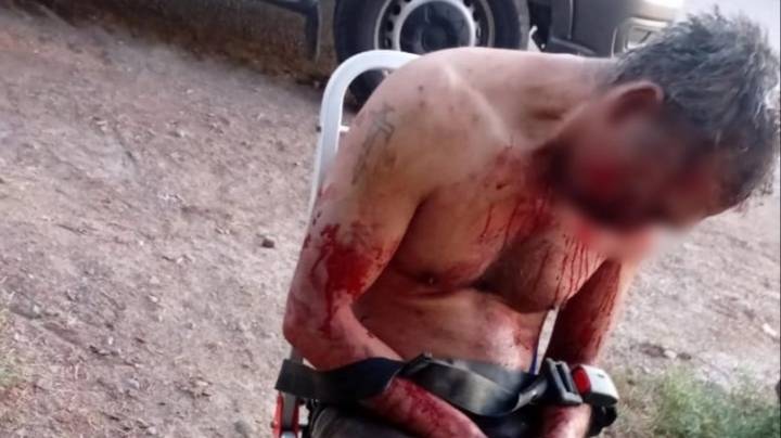 El hombre que fue agredido por su sobrino por una infidelidad tiene cráneo y mandíbula rota